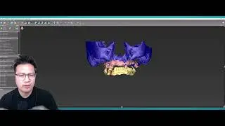 Optisplint SCANCAPS are now RADIOPAQUE!