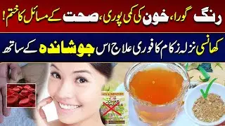 Fair Colour, Anemia, Health Problems Eliminated | Must Watch | City 21