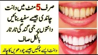 How To Whiten Teeth In 5 Minutes How To Make Homemade Toothpaste Urdu Hindi.