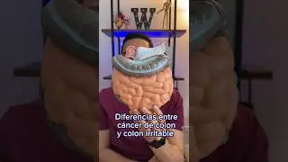 Diferencias entre c&aacute;ncer de colon y colon irritable | Dr. William Guerrero. #shorts #medicina