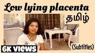 Low lying placenta in Tamil | Placenta position | Tamil | நஞ்சுக்கொடி இரக்கம் | Anterior, Posterior