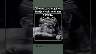 Wanneer je baby een hartje maakt met zijn handjes.. 🫶 #baby #zwanger #echo #love #hart