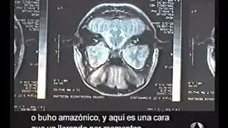 3 abril 2002 falsos curanderos   Al Descubierto A3
