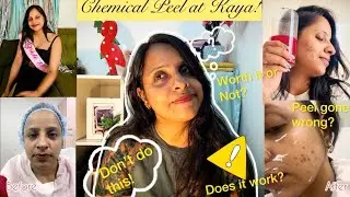 Kaya Skin Clinic&rsquo;s chemical peel | My honest review #skincare #viral #trending #ytshorts #beauty 