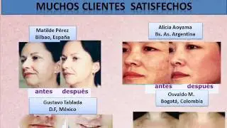 C&oacute;mo Quitar los Lunares de la Cara