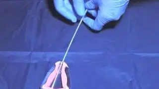 Endometrial Biopsy