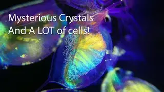 Different Single Celled Organisms And More - Under The Microscope