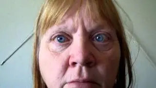 Patient with eye disorder at Pro-Active Wellness Danville IL.