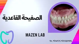 طريقة صنع الصفيحة القاعدية الاكريليه