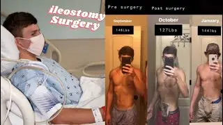 Getting Diagnosed with Crohn’s Disease…