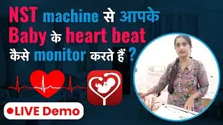 NST Machine से Baby की Heart Beat Monitor कैसे करते है ? | How to Monitor Baby's Heartbeat with NST