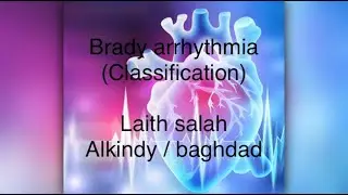 brady arrhythmia ( classification )