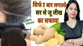 Lice and Nits Removal Home Remedy | जू और लीख से छुटकारा पाने का उपाय How To Get Rid Of Lice And Nit