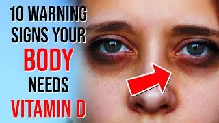 10 WARNING Signs Your Body Is LACKING Vitamin D - (Vitamin D Deficiency)