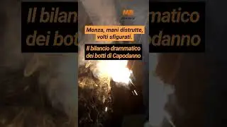 Monza: mani distrutte, volti sfigurati. Il bilancio drammatico dei botti di Capodanno