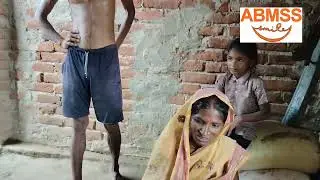 Free Opration CLEFT LIP AND PALATE for ABMSS RAJESHWAR HOSPITAL KANKARBAGH PATNA