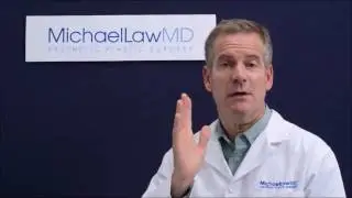 Necklift vs  Facelift Surgery