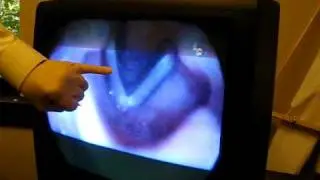 Steph's Vocal Folds