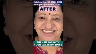 Full Mouth Dental Implant Rehabilitation in Mumbai - Dr Mayur Khairnar