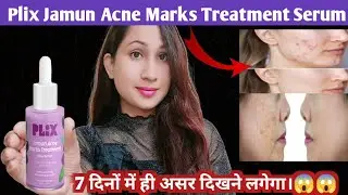 Plix Jamun Acne Marks Treatment Dewy Serum Honest Review|plix Jamun Acne Marks Serum|2025