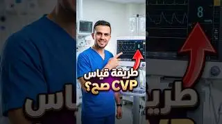 إزاي تقيس الـ CVP بدقة؟ &ndash; Tips & Tricks You Must Know!