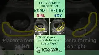 👶 8 Weeks & Already Guessing? 💙💗 Ramzi Theory Says&hellip; 🤔 #ultrasound