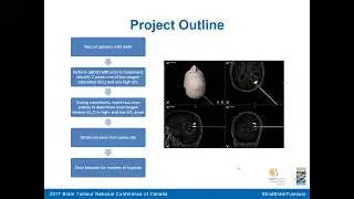 Research Symposium: Quantitative blood oxygenation level dependent (qBOLD) MR imaging of gliobl...
