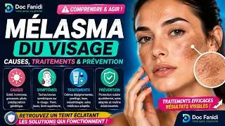 M&eacute;lasma du visage : d&eacute;finition et traitements