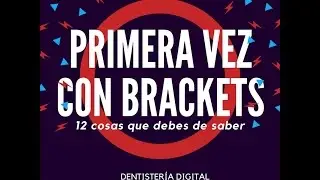 BRACKETS - 12 Cosas que debes saber cuando te ponen brackets por primera vez