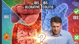 Irritable Bowel Syndrome&hellip; or Something Else?
