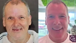 G4 By Golpa Patient Testimonials - Mario's Story