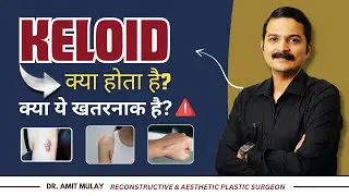 Struggling With Keloid Scars? Here’s What You Should Know | Dr. Amit Mulay | Plastic Surgeon