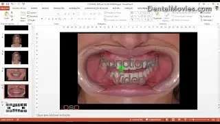 Digital Smile Design - Christian Coachman & Livio Yoshinaga - PART 1/4