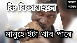 Eating Disorder / Types Of Eating Disorders / খোৱাৰ বিকাৰ সমন্ধে জানো আহক