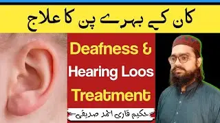 Behra Pan ka ilaj | Kam Sunai Dena ka ilaj | Deafness and Hearing Loos Treatment| Pakistan Health Tv