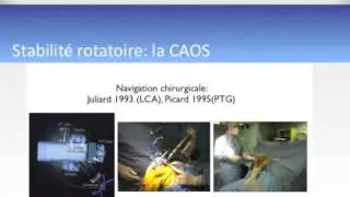 Analyse cin&eacute;matique objective non invasive de la laxit&eacute; du genou