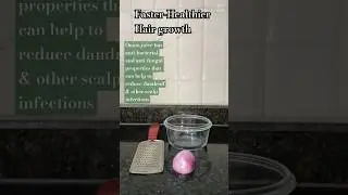 🧅Faster-Healthier Hair growth #onionjuice #hairgrowth #haircare #baldnesssolution #hair #ytshorts