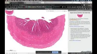 Locating Epithelial Tissue on Histology Guide and PAL
