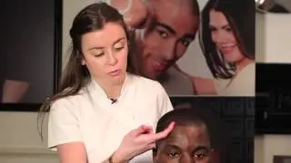 Hairline Laser Removal by HIS Hair Clinic on Andre to rectify another provider's treatment