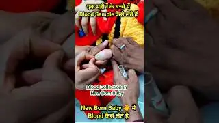 How to take blood sample in a new born baby / How to take blood sample in small children in one m...