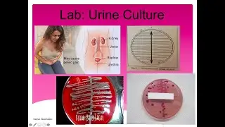Urine Culture Lab