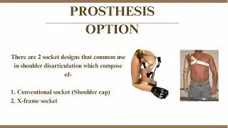 Upper limb amputation level and prosthetic management 🦾 #Bscpo #bhpiposchoool #BScPOBHPI