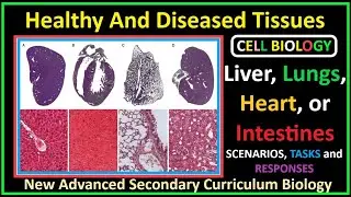 Cell Biology-9- Healthy Tissues (Liver, Lungs, Heart, or Intestines) and Diseased Tissues