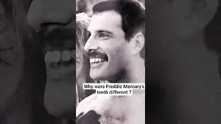 Why Were Freddie Mercury&rsquo;s Teeth Different? ‖ What Are Supernumerary Teeth?
