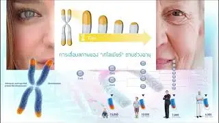Thyroid Disease Therapy by Nutraceutical EP2 โรคไทรอยด์ world star thailand ปรึกษาโทร 098-924-7165