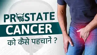 Prostate Cancer | Early Signs You Shouldn’t Ignore | प्रोस्टेट कैंसर क्या है? | #prostatecancer