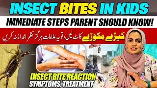 Insect Bites in Children | Keery Makroy Kat Leyein | बच्चों में कीड़े मकोड़े के काटने पर क्या करें