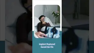 💥 The Implant That Saved a Life! | Breast Implants in Gurugram