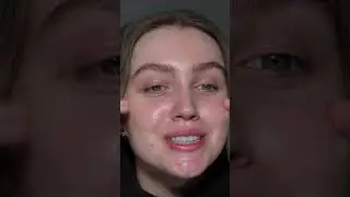 Getting my sparkle back🥹✨ my big brow transformation 😍 #brows #eyebrows #selflove #vlog #selfcare