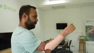 Tunisian startup develops AI-powered prosthetics for amputees | REUTERS